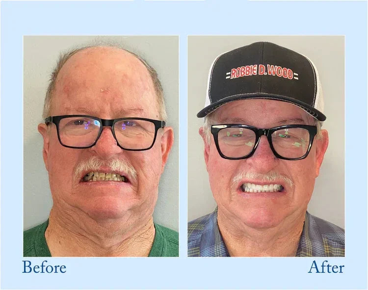 🦷High-end custom-made complete denture set New HomeGoods