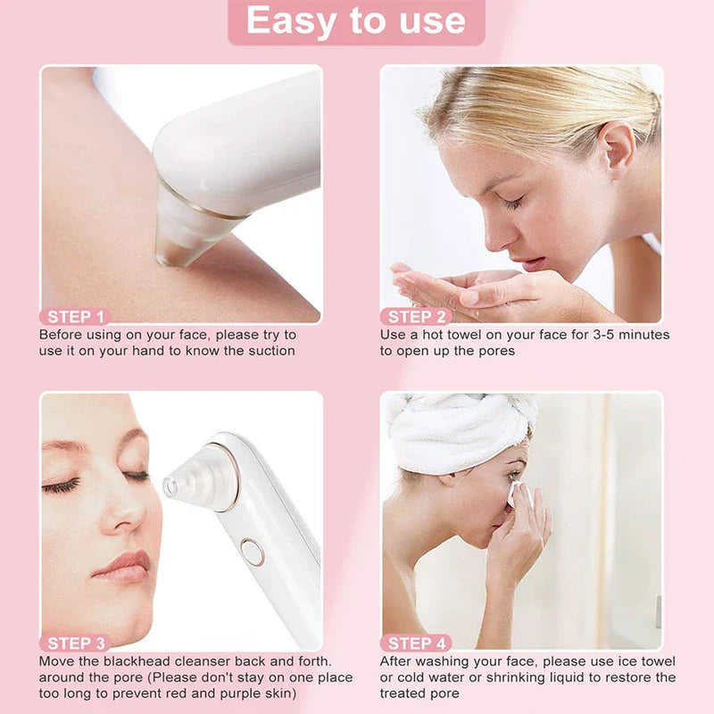 Adjustable Suction Pore Cleansing Beauty Tool