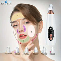 Blackhead Remover Vacuum Pore Cleaner (6 Probes)