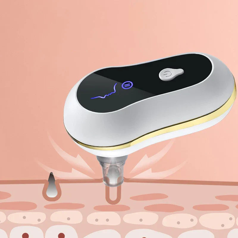 Blackhead Remover Vacuum Pore Cleaner