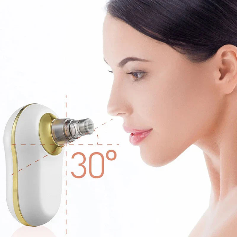 Blackhead Remover Vacuum Pore Cleaner Tool
