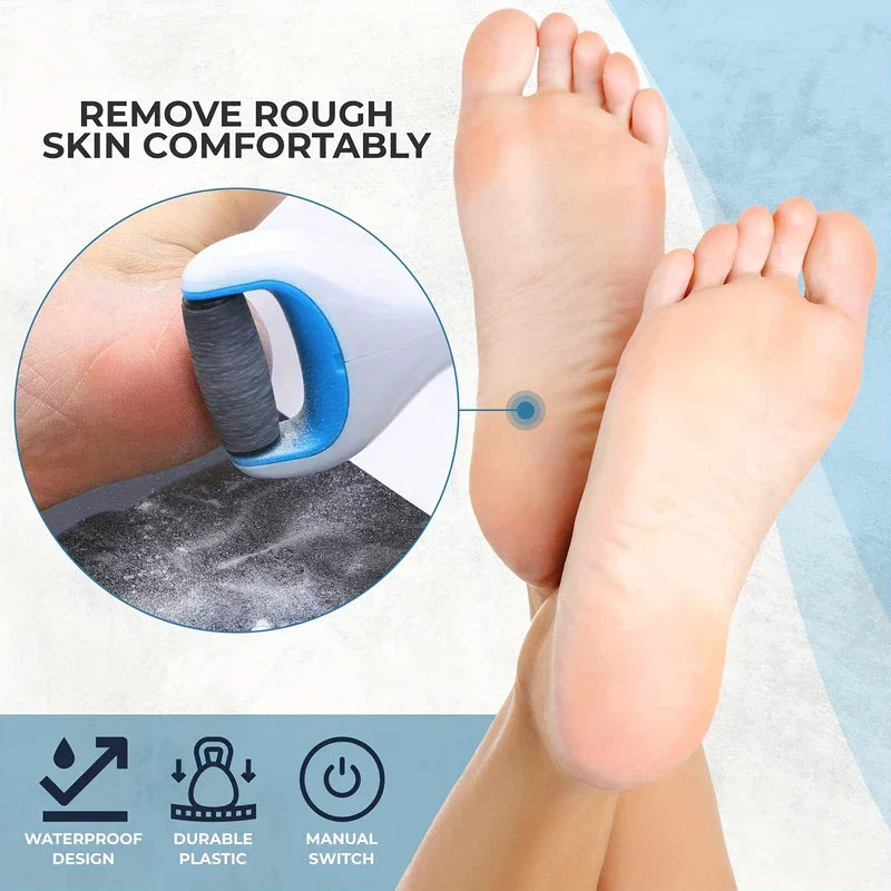 Electric Callus Remover Foot File (USB-Battery)