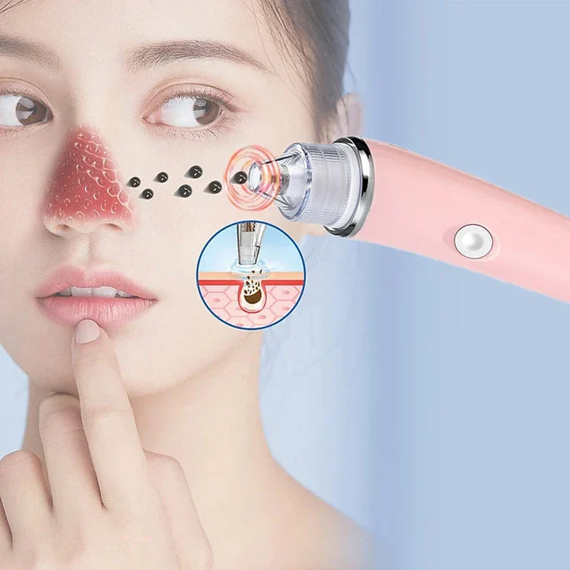 Electric Facial Pore Suction Cleaner Kit