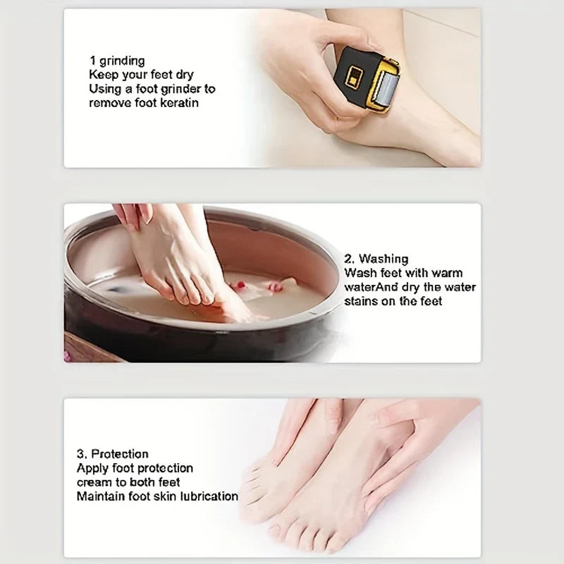 Electric Foot Callus Remover Rechargeable