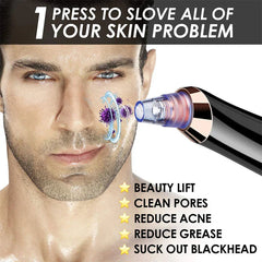 Facial Comedone Extractor Vacuum Device