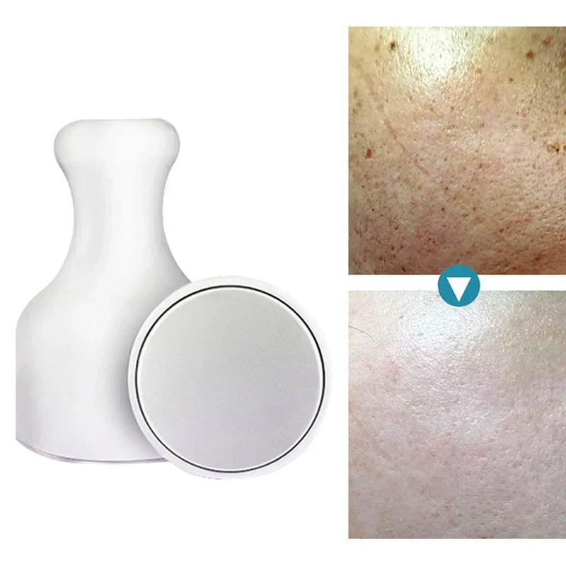 Ice Roller Face Massager Tool