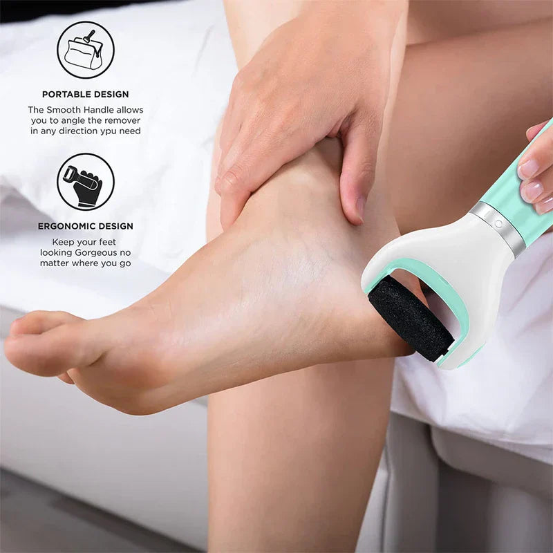 Pedicure Heel Scraper Dead Skin Removal Rasp