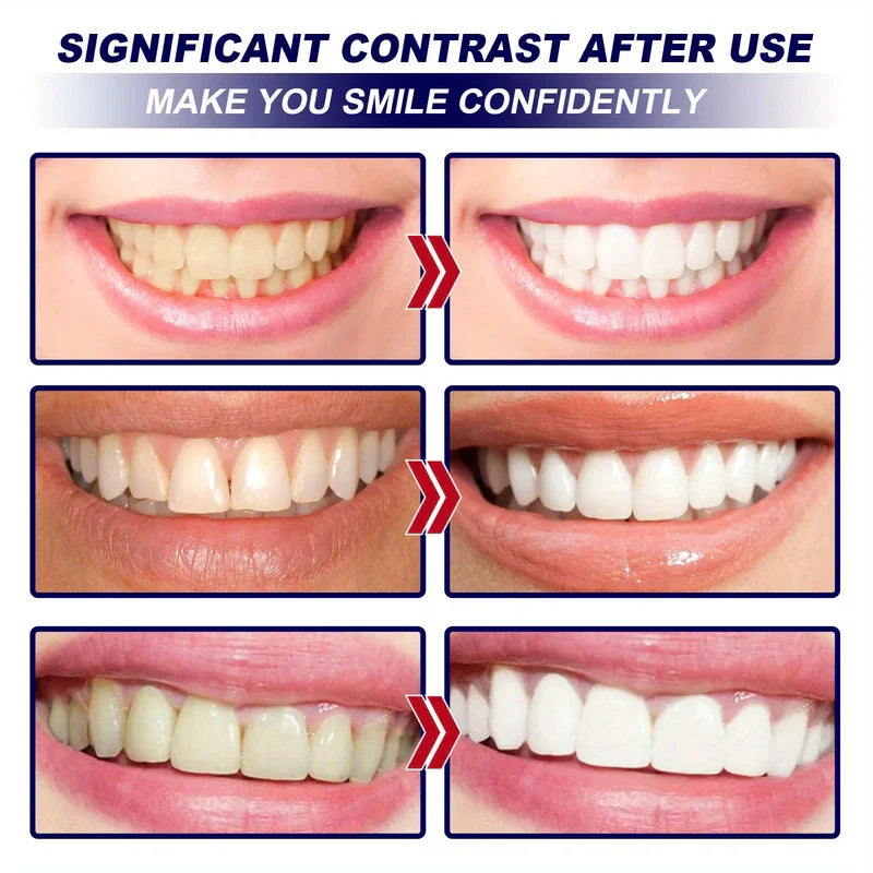 Professional Teeth Whitening Strips