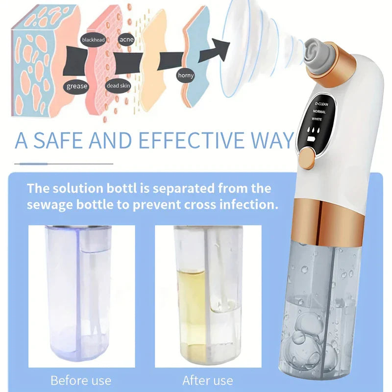 Rechargeable Blackhead Remover Vacuum Pore Cleaner