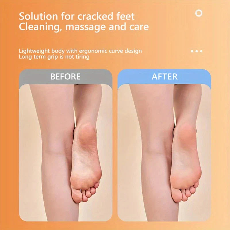 Rechargeable Electric Foot File Callus Remover Kit