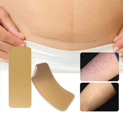 Silicone Scar Removal Sheets Tape Strips