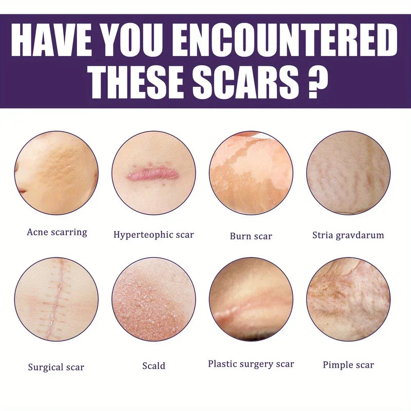Silicone Scar Removal Sheets Tape Strips