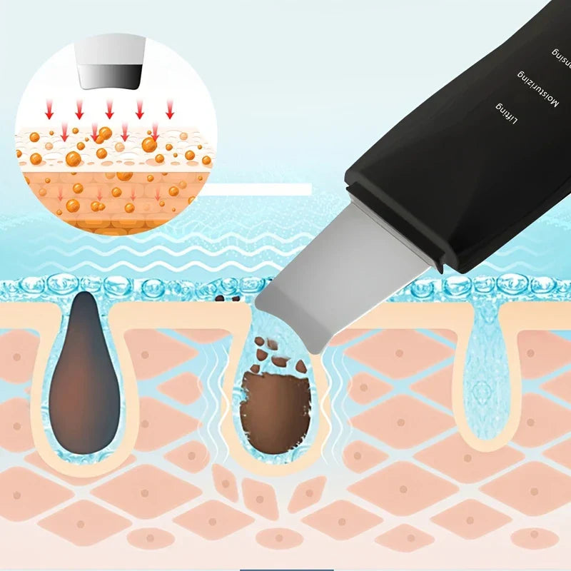 Ultrasonic Facial Skin Scrubber Spatula