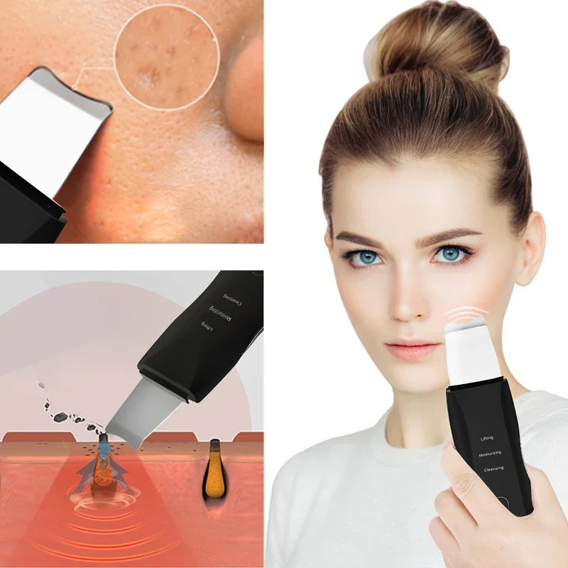 Ultrasonic Facial Skin Scrubber Spatula