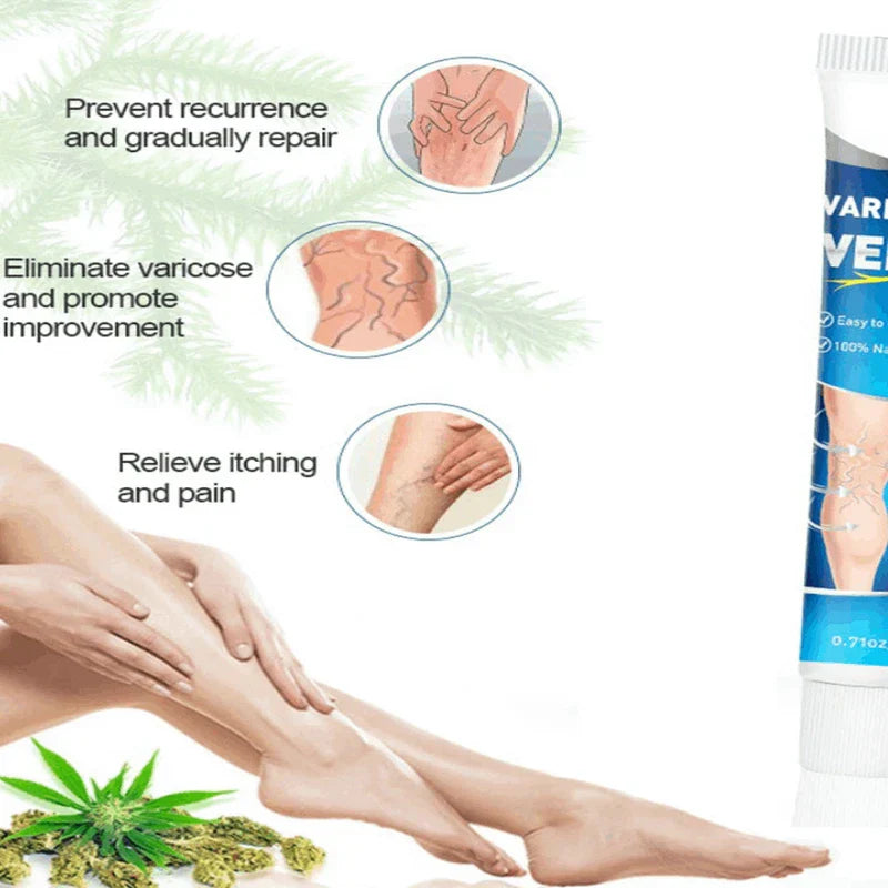 Varicose Vein Treatment Relief Cream