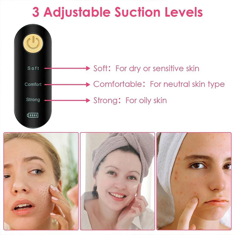 Visual Blackhead Remover Vacuum With Camera
