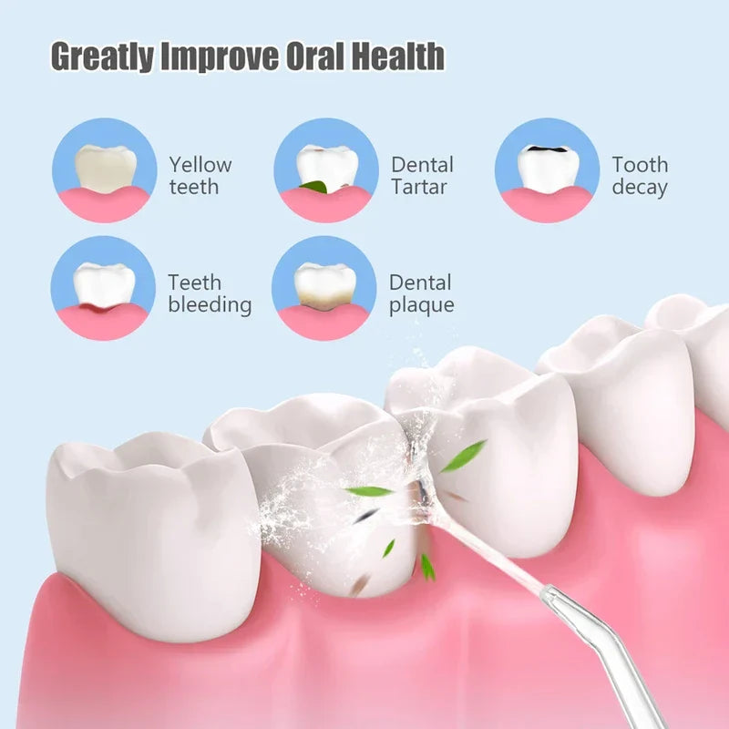 Water Flosser Oral Irrigator Tool